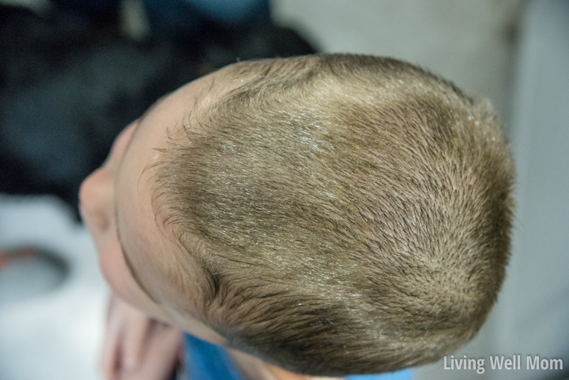 Coconut oil in a boy's hair to help treat flaky scalp.