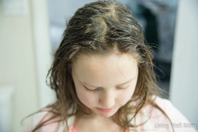 Got dandruff? Here's an all-natural flaky scalp treatment that's an effective natural alternative to harsh chemicals and it really works! (Safe for kids and adults!)