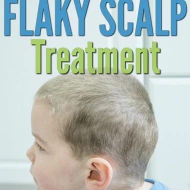 flaky scalp treatment wording with boy and dandruff hair