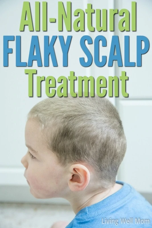 flaky scalp treatment wording with boy and dandruff hair