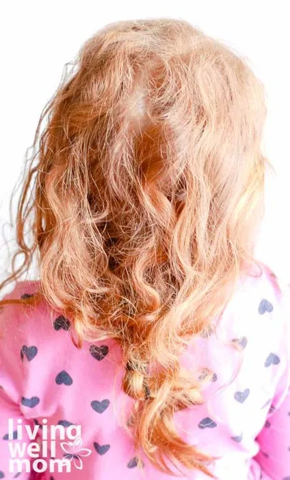 tangles and knots on a child's head