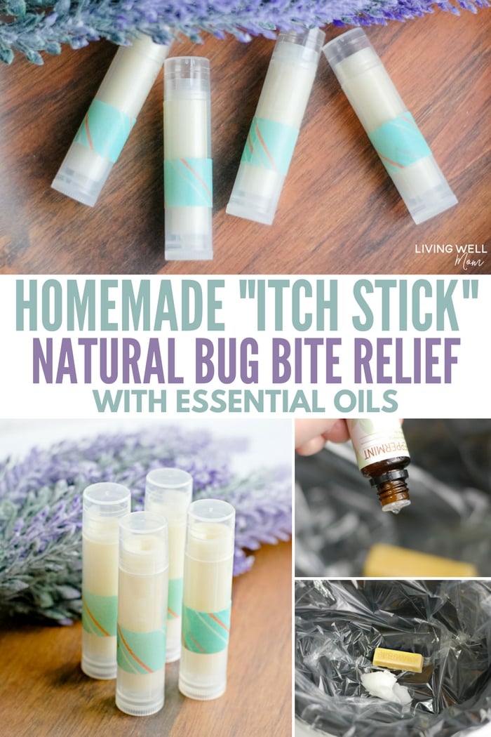 diy mosquito bite itch relief