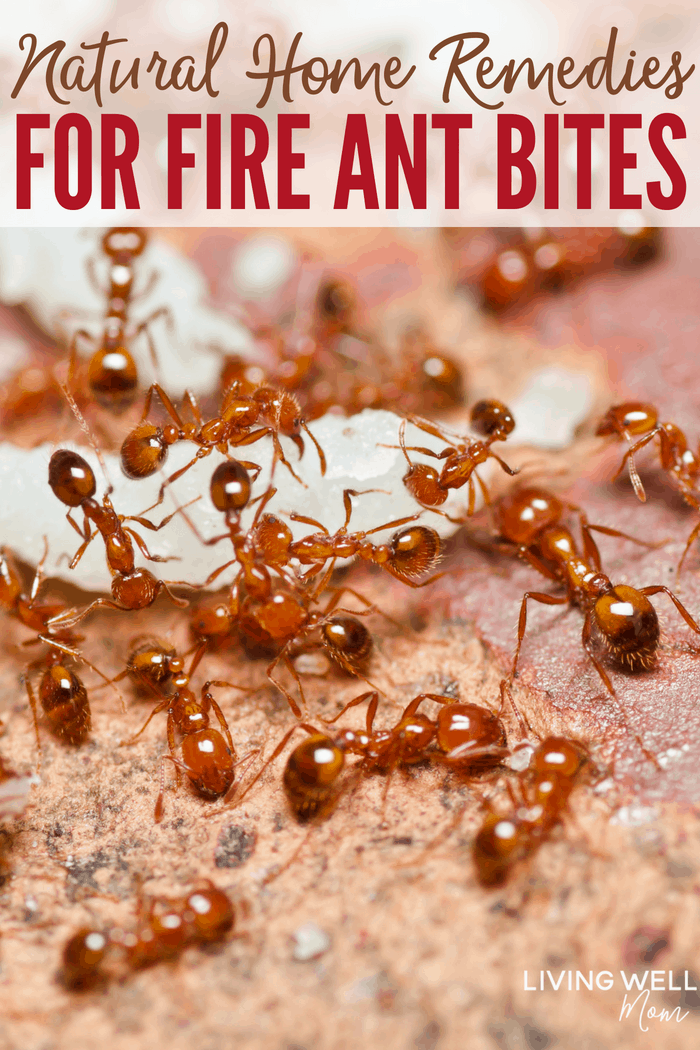 heal fire ant bites