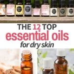 essential oil bottles for dry skin