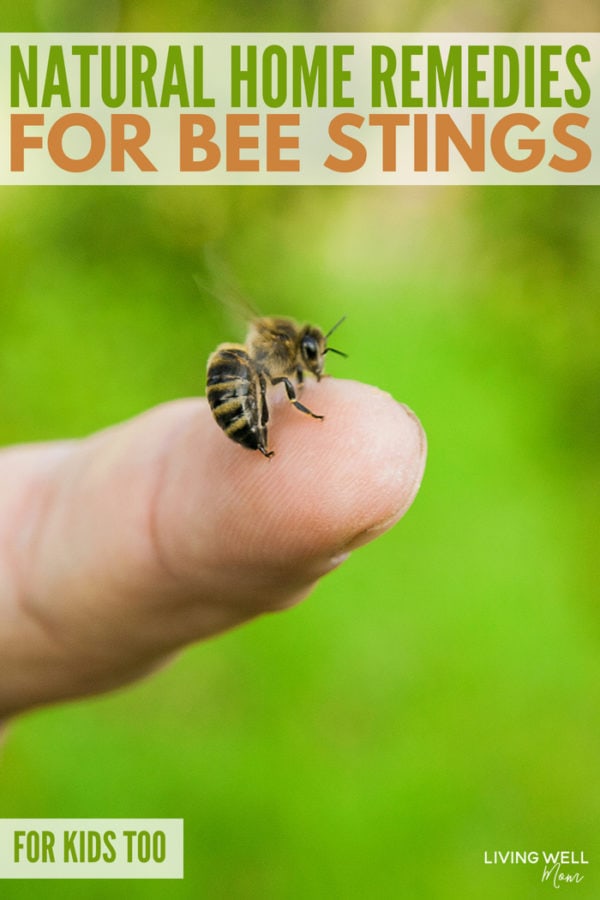natural home remedies for bee stings