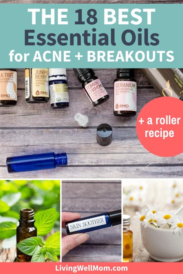 The 18 Best Essential Oils for Acne, Pimples, and Oily Skin + How to