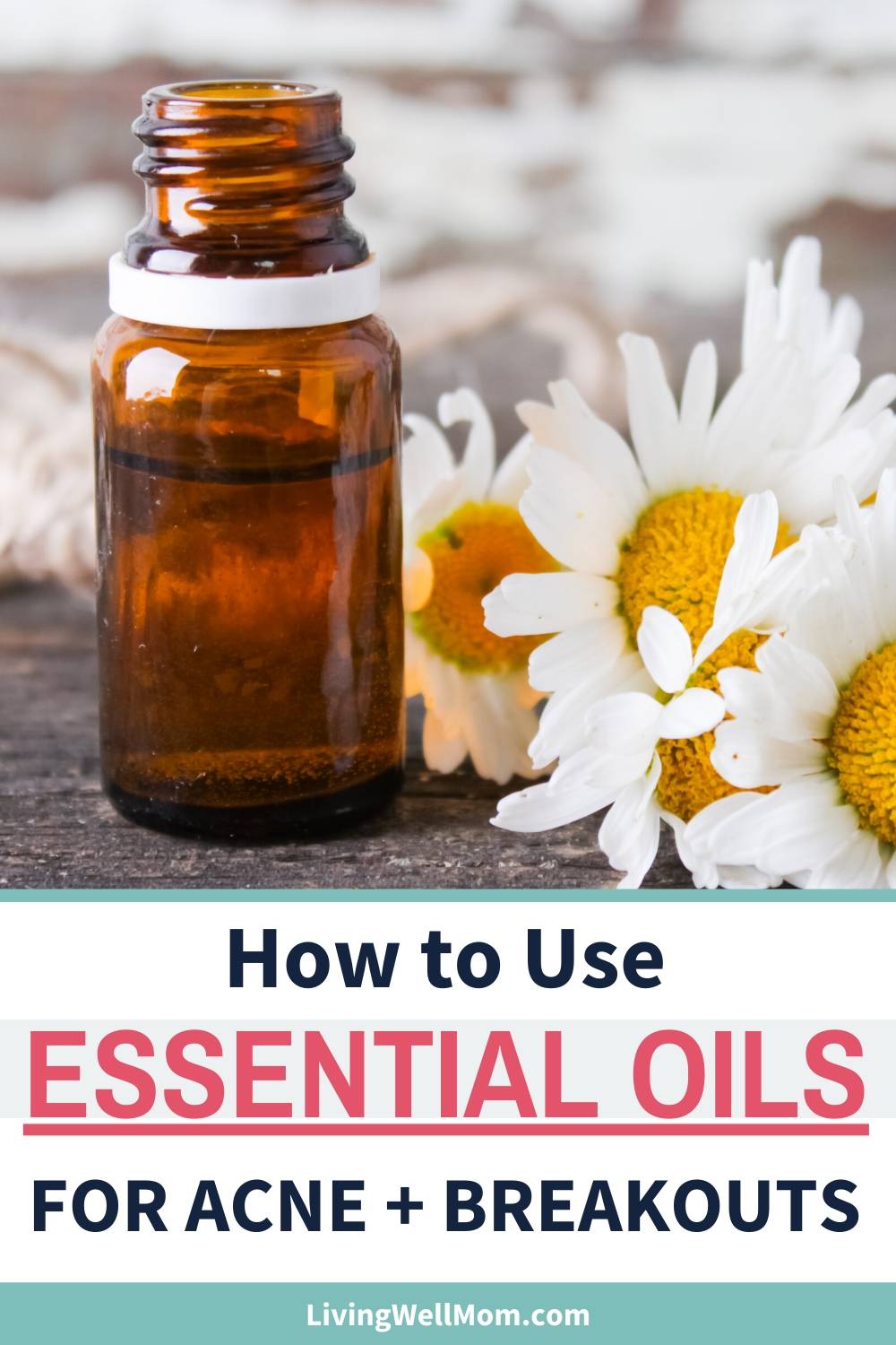 The 18 Best Essential Oils For Acne Pimples And Oily Skin How To Use Them
