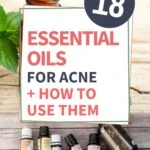 essential oils for acne and how to use them