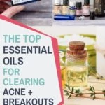 best essential oils for clearing acne and breakouts