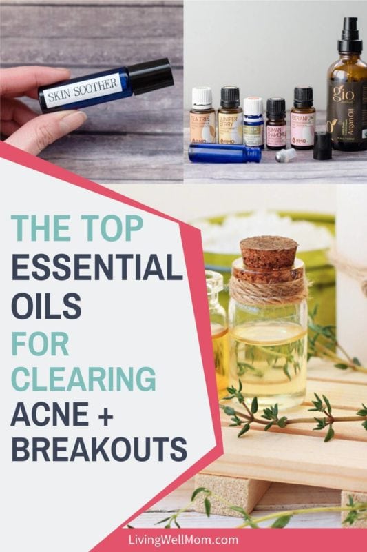 The 18 Best Essential Oils for Acne, Pimples, and Oily Skin + How to ...