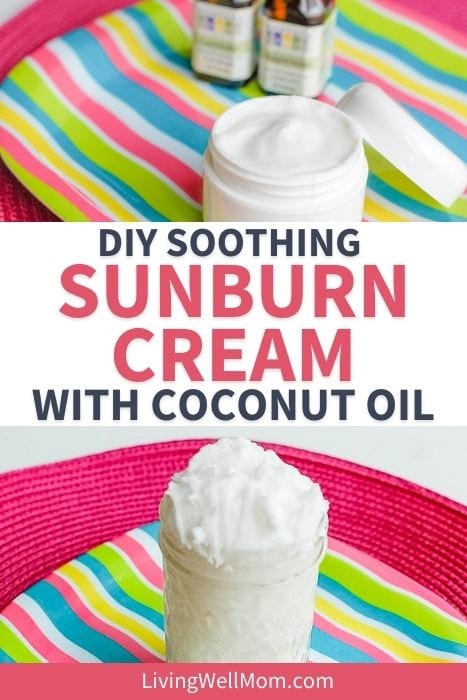 Whipped sunburn cream made with coconut oil