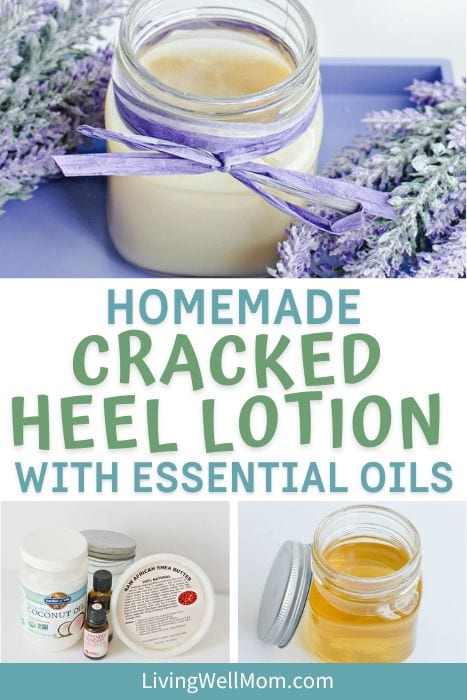 DIY soothing cracked heel cream pin image