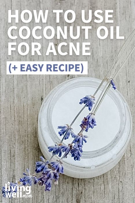 how to use coconut oil for acne (+ easy recipe) pin