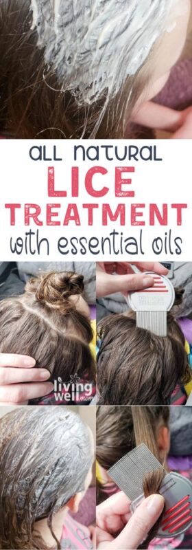 all natural lice treatment with essential oils pin