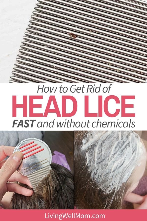 Home Remes For Getting Rid Of Head Lice And Nits My Bios