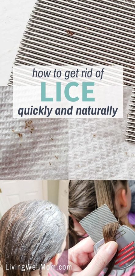 How to Get Rid of Lice & Nits Without Chemicals - Living Well Mom