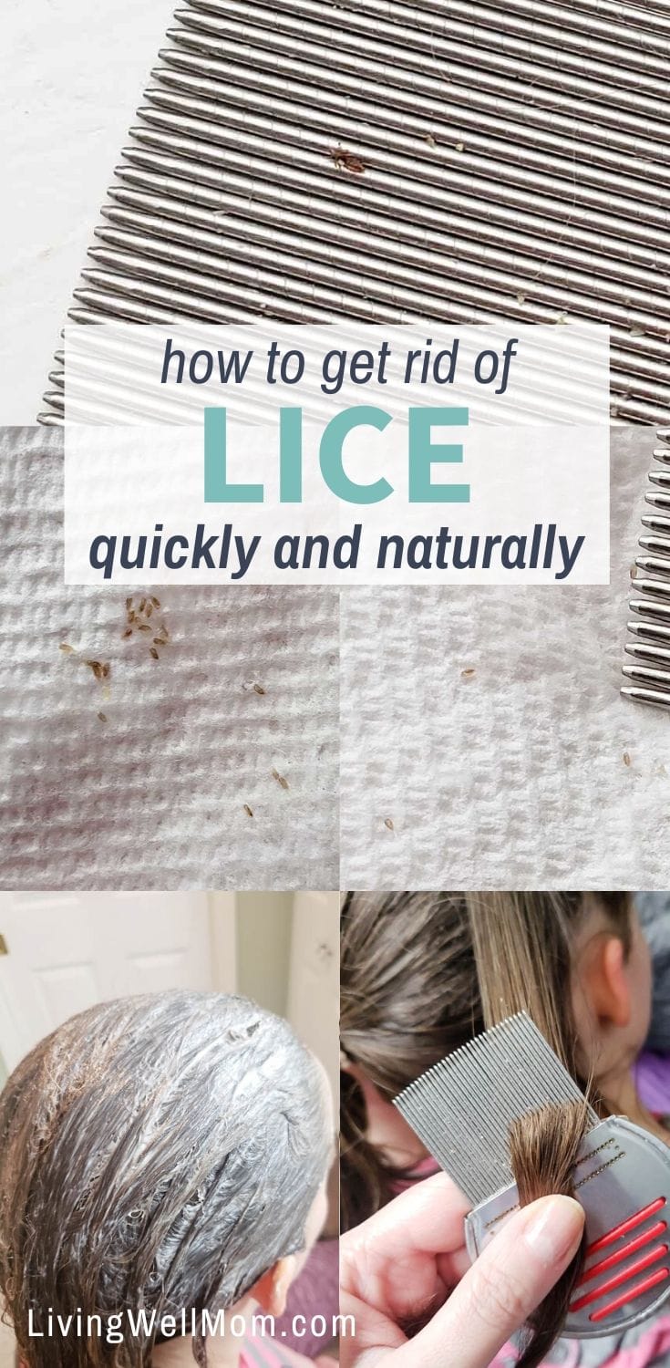 how to get rid of lice quickly and naturally pinterest image