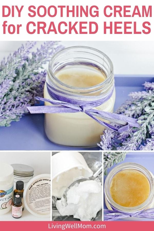 Homemade Cracked Heel Cream With Essential Oils