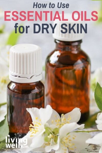 essential oils for diabetic dry skin